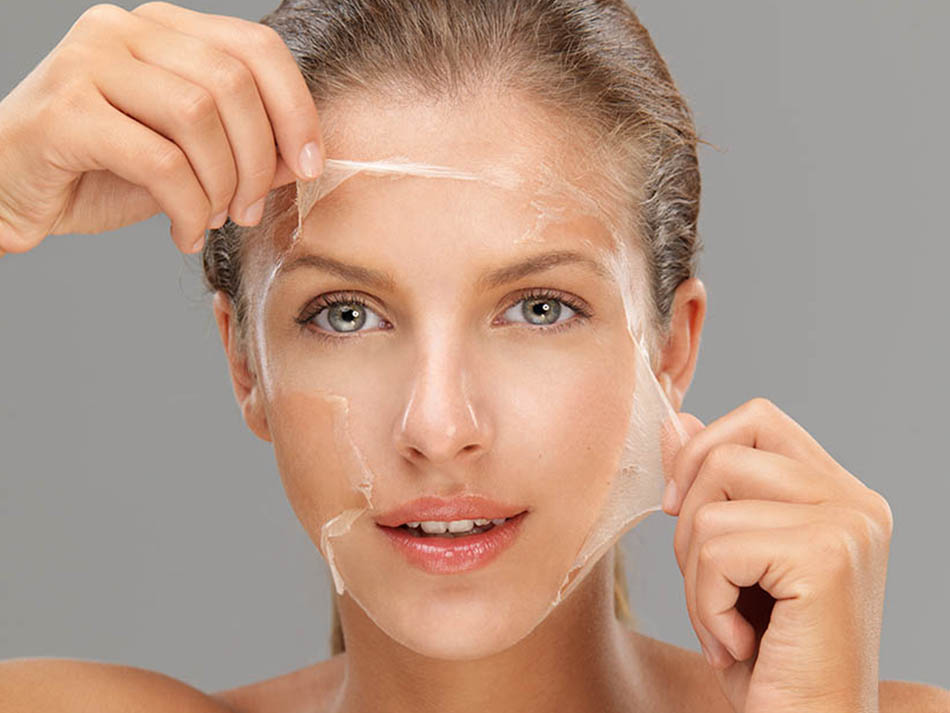 peeling-quimico